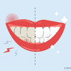 how to whiten sensitive teeth 