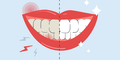 how to whiten sensitive teeth 