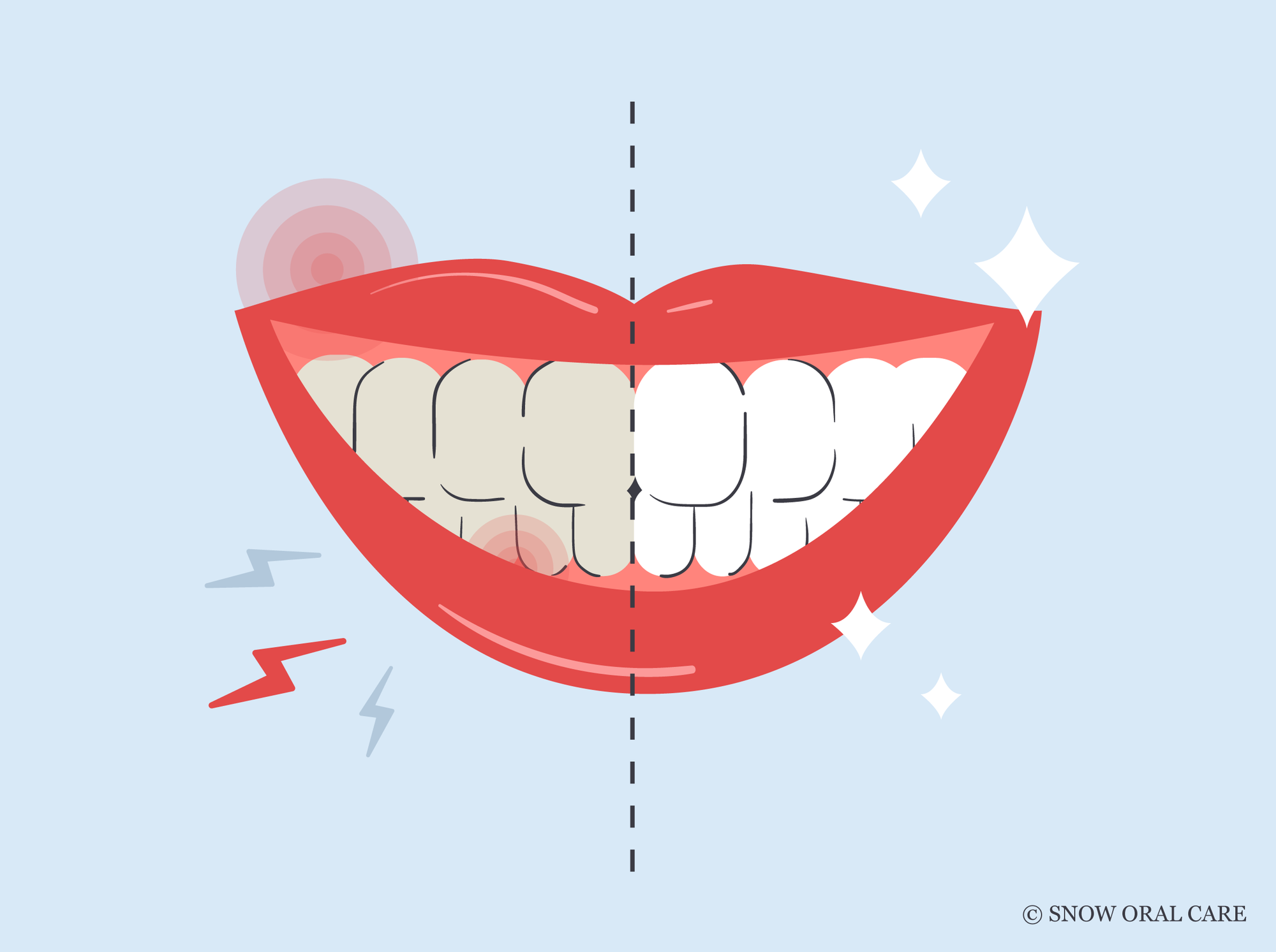 how to whiten sensitive teeth 