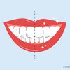 how to whiten teeth instantly 