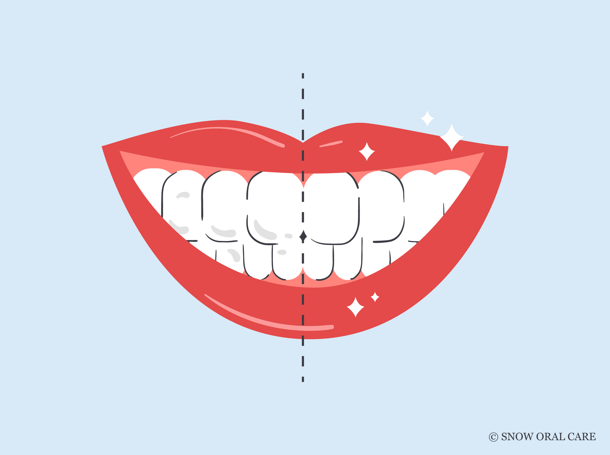 how to whiten teeth instantly 