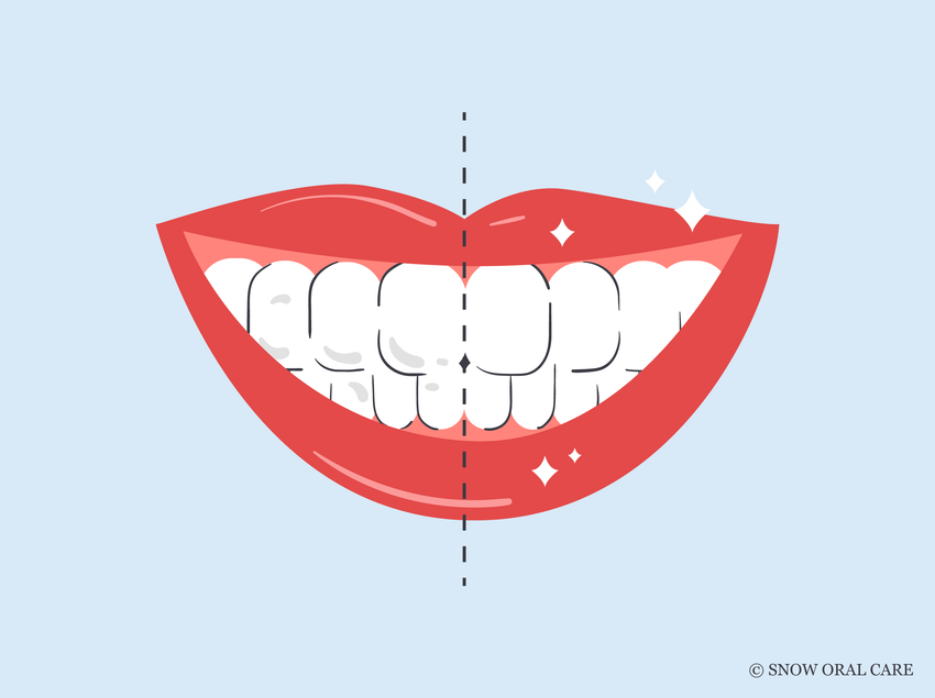 how to whiten teeth instantly 