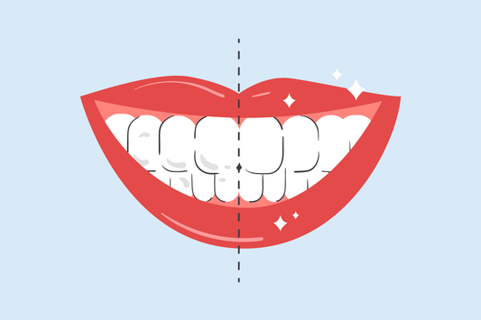how to whiten teeth instantly 