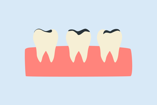 i want to whiten my teeth but i have fillings 