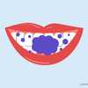 is purple teeth whitening safe 