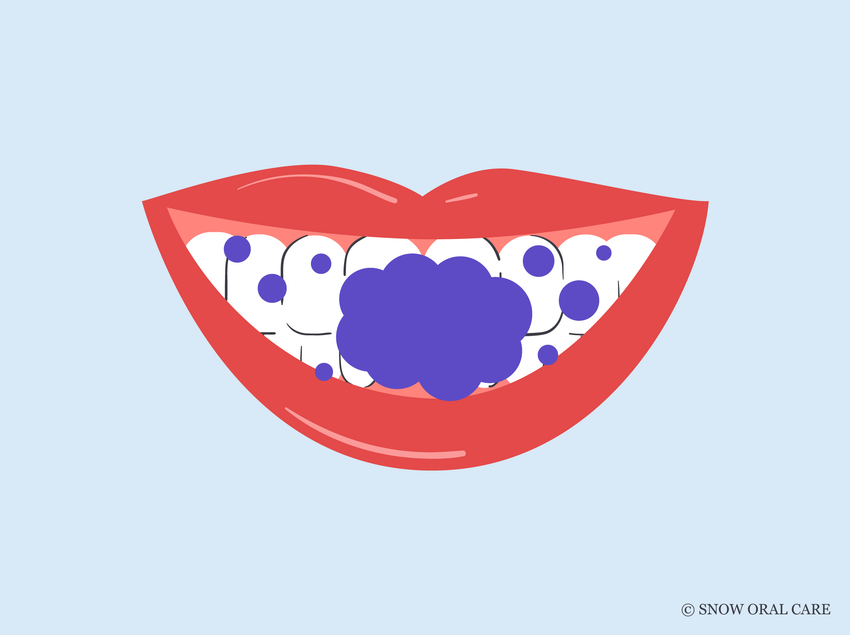 is purple teeth whitening safe 