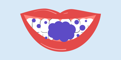 is purple teeth whitening safe 
