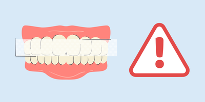 is teeth whitening safe 