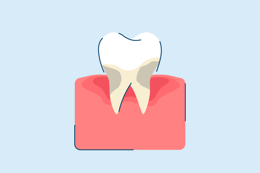 Periodontitis: Symptoms, Causes, and Treatments