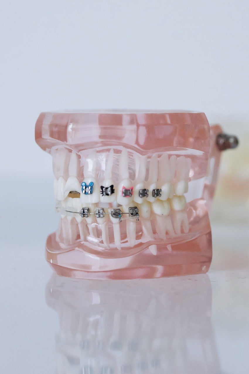 Invisalign Review