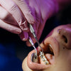 How to Get Whiter Teeth With Braces