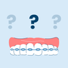 power chain braces