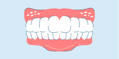 professional teeth whitening 