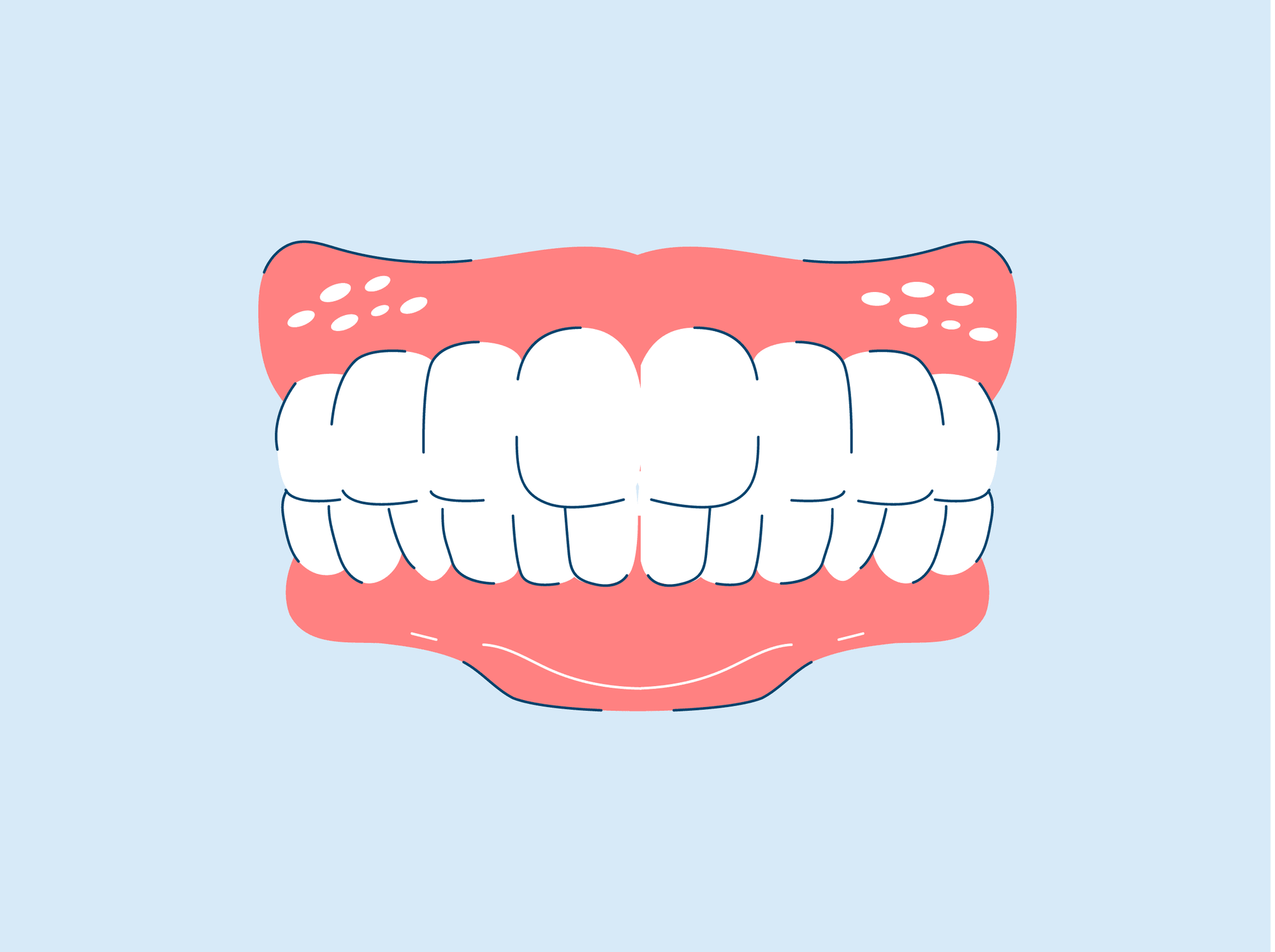 professional teeth whitening 