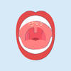 Roof of Mouth Hurts? Here's What May Be Causing it and Treatments.
