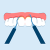 Scaling and Root Planing for Gum Disease