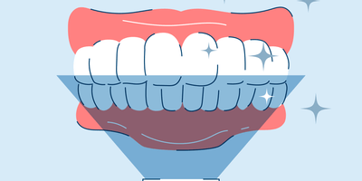 should i whiten my teeth