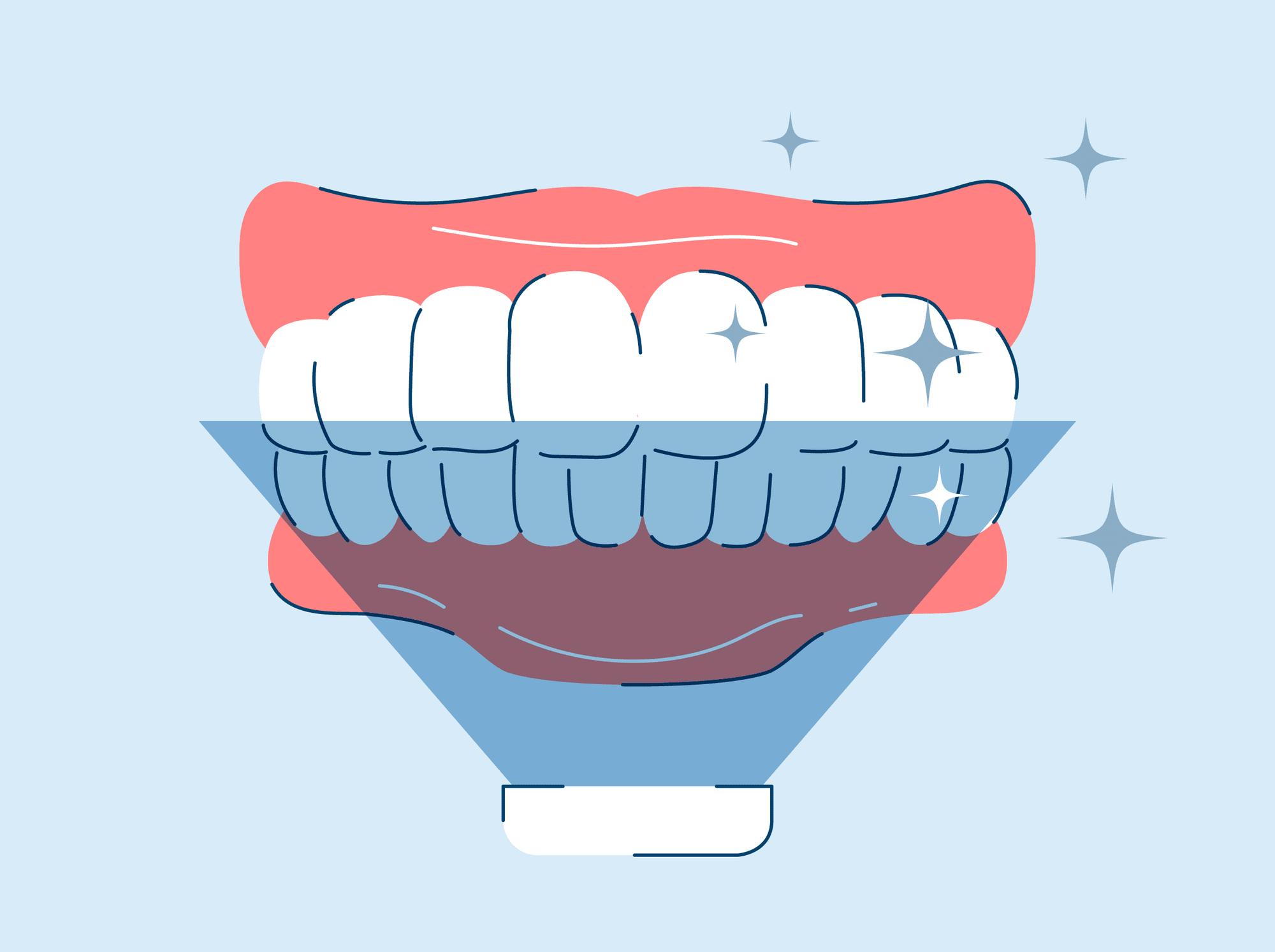 should i whiten my teeth