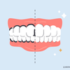 silver diamine fluoride stain removal from teeth 