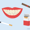 smokers teeth whitening 