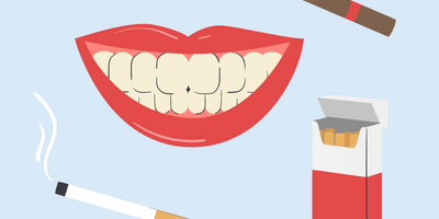 smokers teeth whitening 