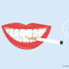 smoking after teeth whitening 
