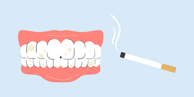 smoking yellow teeth 