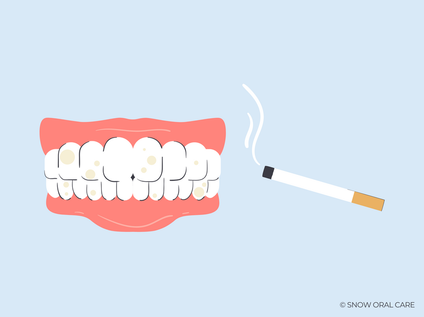 smoking yellow teeth 
