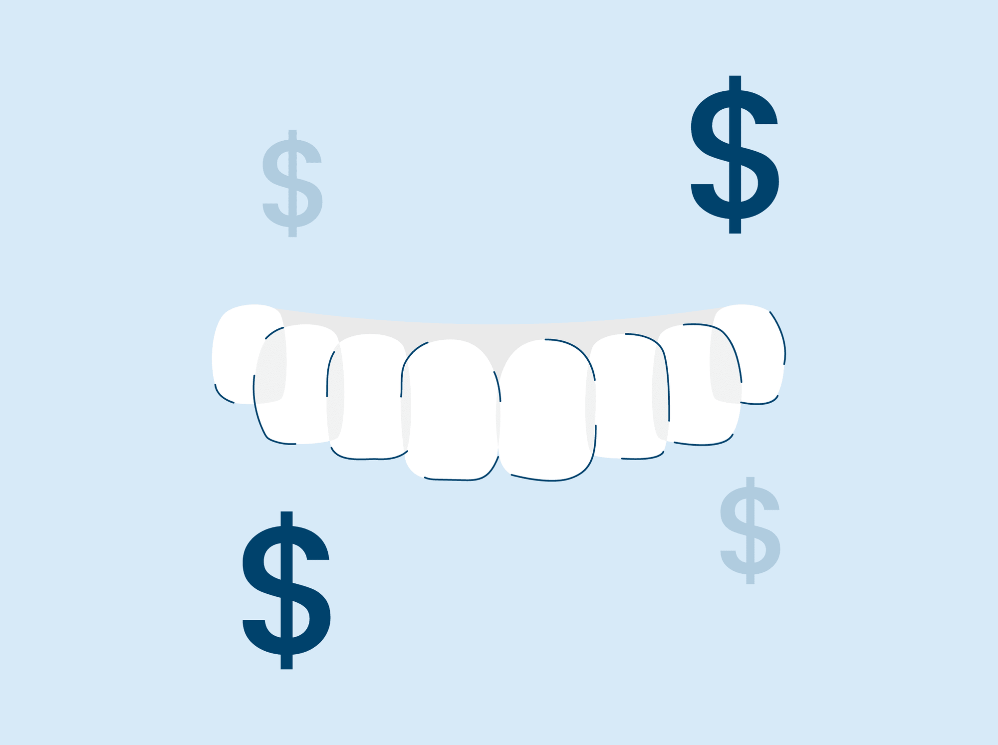 snap on veneers types and costs