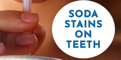 Does Diet Coke Stain Teeth? Scientific Evidence and Prevention Strategies