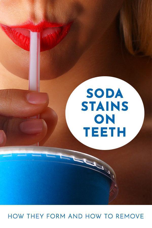 Does Diet Coke Stain Teeth? Scientific Evidence and Prevention Strategies