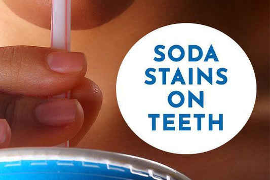 Soda Stains on Teeth: How they Form and How to Remove