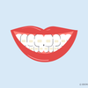 stained teeth after braces 