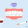 stained teeth causes