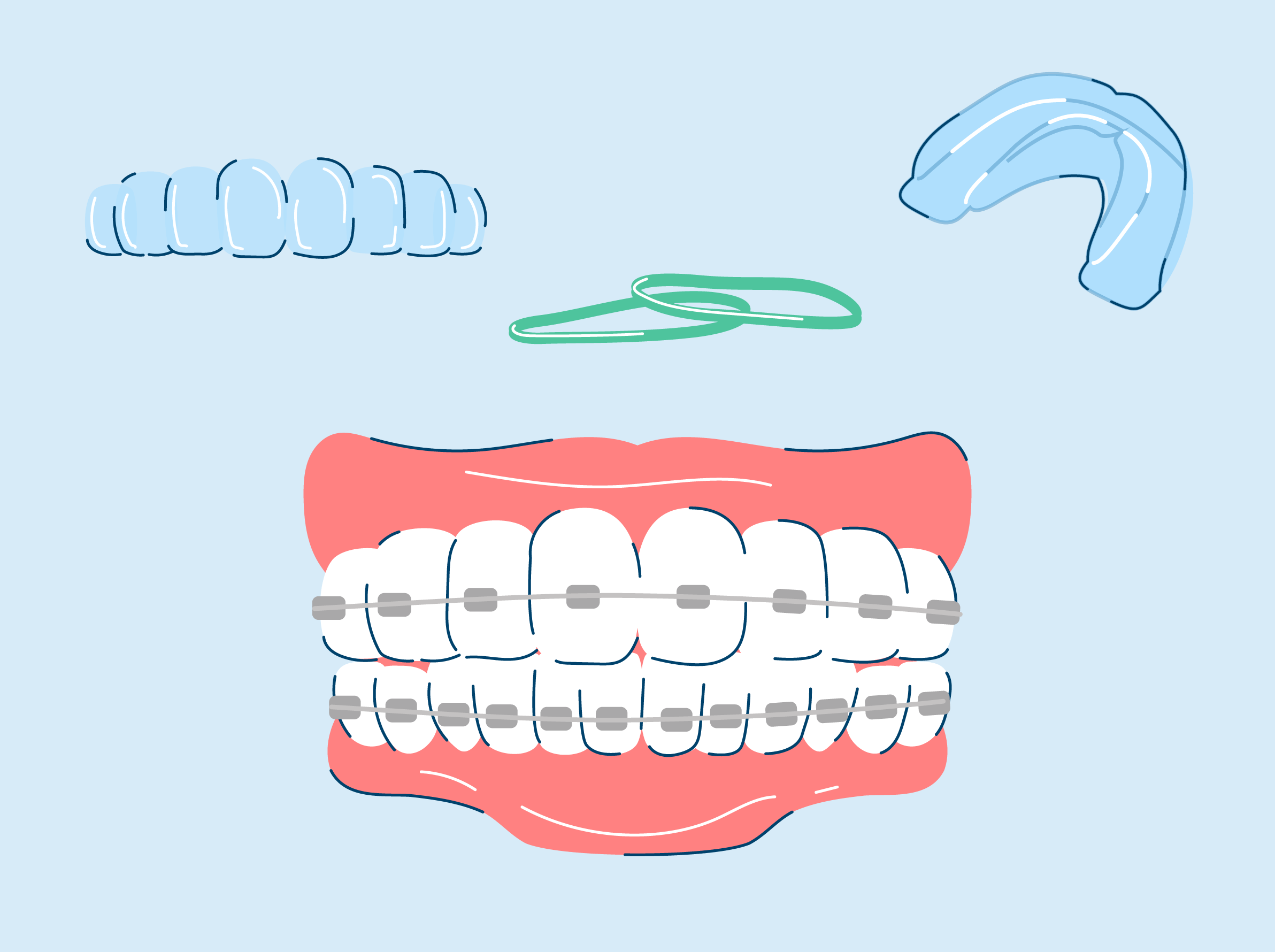 5 Teeth Straightening Options Compared and Explained – SNOW® Oral Care