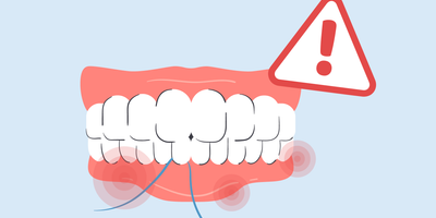 teeth hurt after flossing
