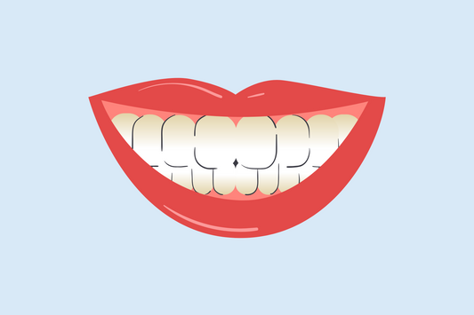 teeth not whitening near gums 