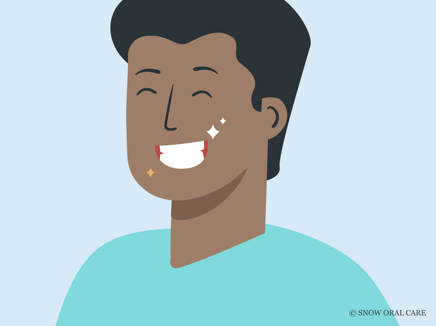 teeth whitening for veneers 
