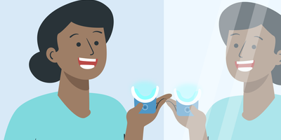 teeth whitening procedure 