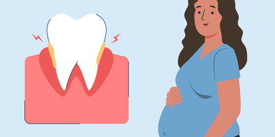 The Risk of Periodontal Disease During Pregnancy