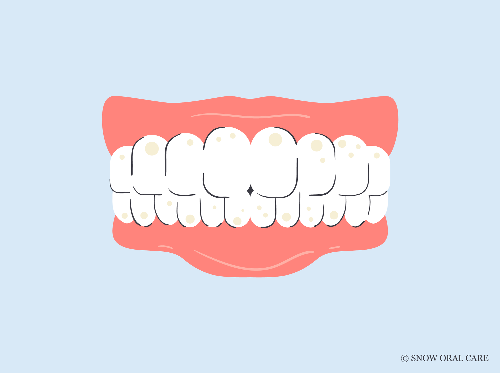 tooth stain vs cavity 