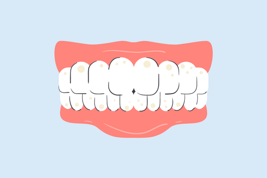 tooth stain vs cavity 