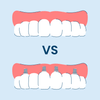 implant supported dentures