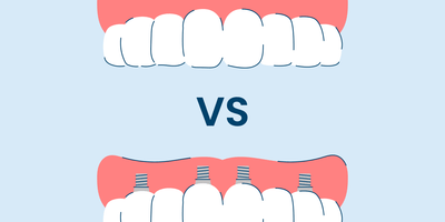 implant supported dentures