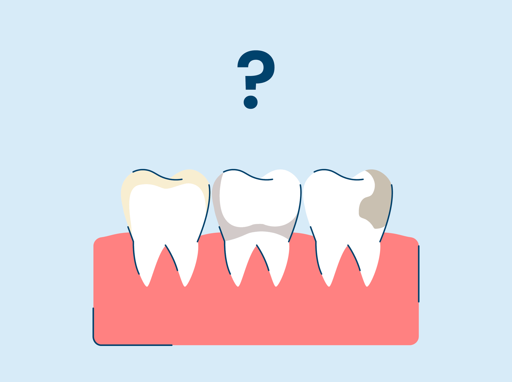 types of teeth stains