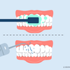 water floss before or after brushing