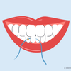 what are the benefits of flossing