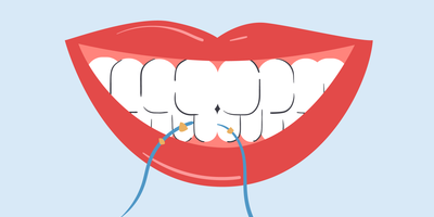 what are the benefits of flossing