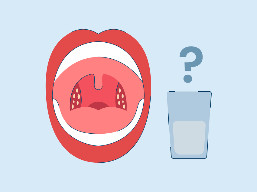 how to get rid of tonsil stones