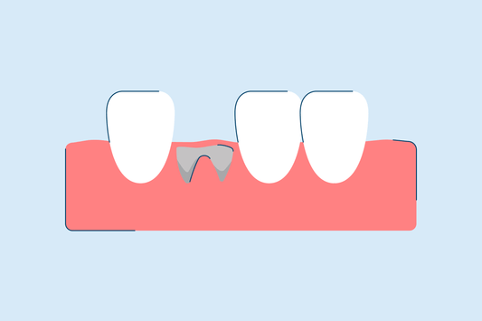 What Does a Dry Socket Look Like?